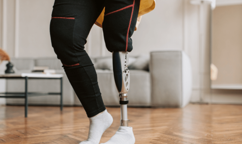 Prótesis de pierna para diabéticos