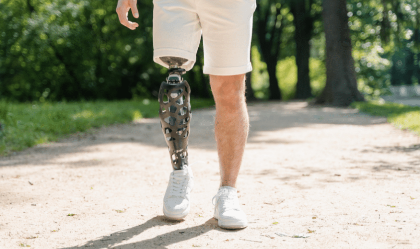 Prótesis de pierna biónica