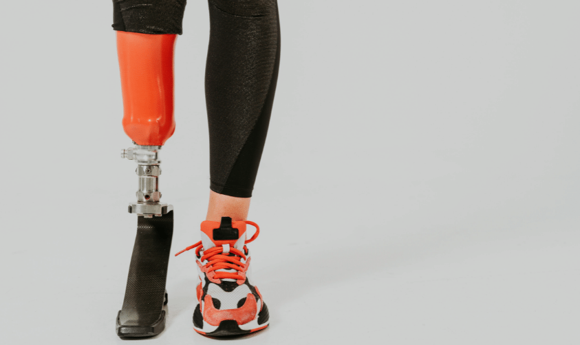 Socket de prótesis de pierna